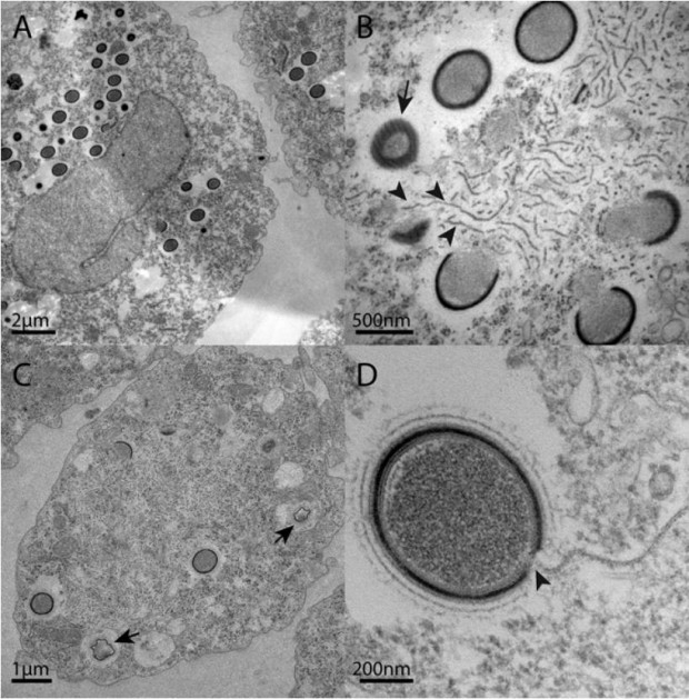 احتمال شیوع ویروس های غول آسای باستانی با آب شدن یخ‌های قطب شمال-Mollivirus sibericum