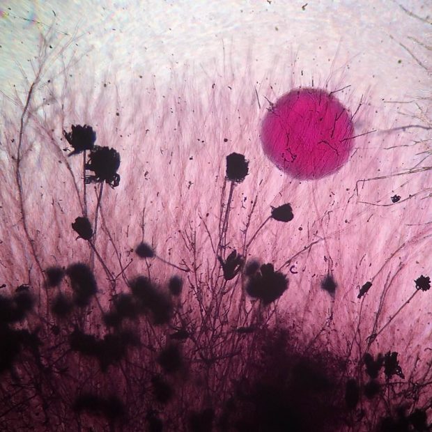 تصاویر میکروسکوپی شگفت‌انگیزی که دنیایی پنهان و عجیب را به ما نشان می‌دهند!